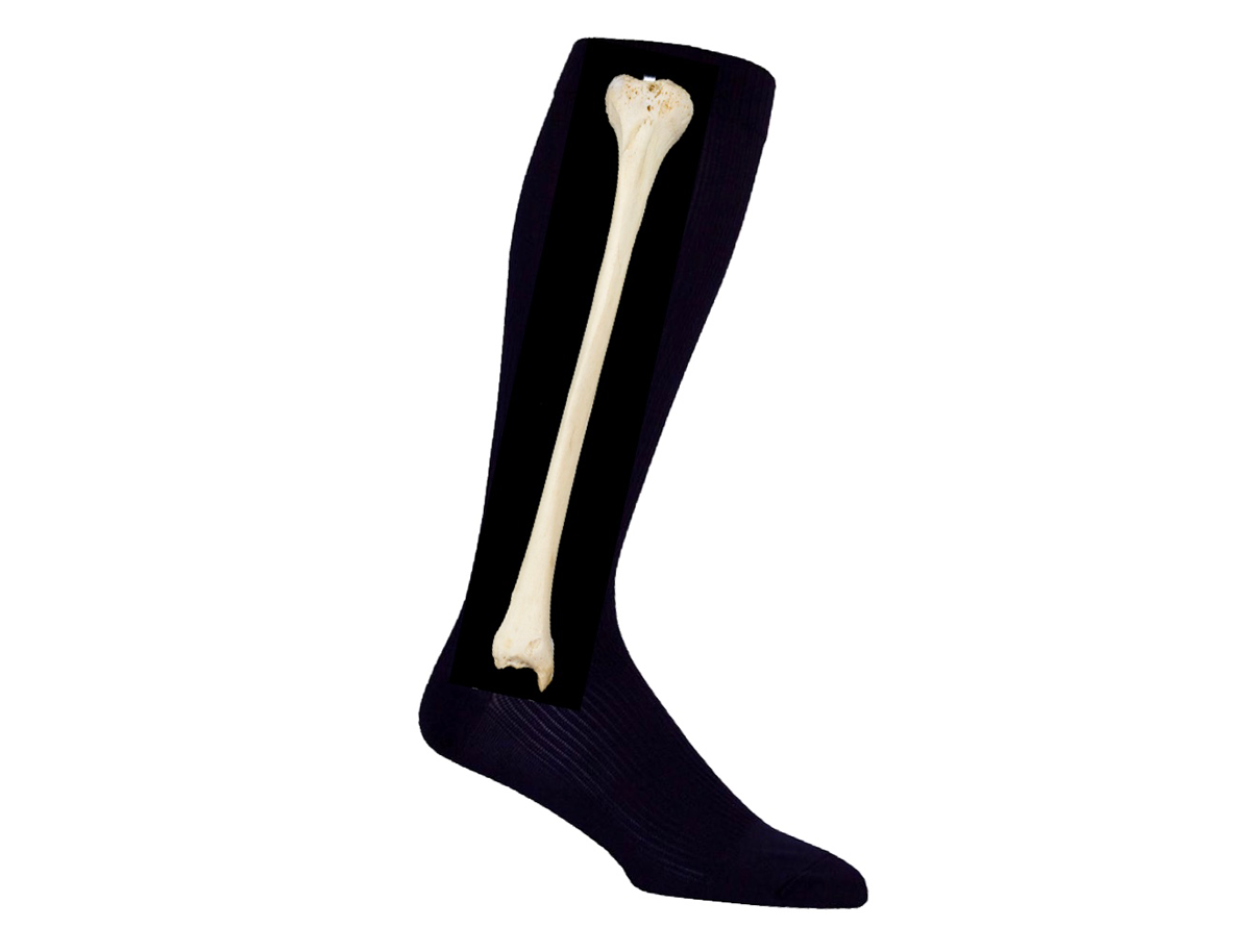 phlebortho-picture-stockings